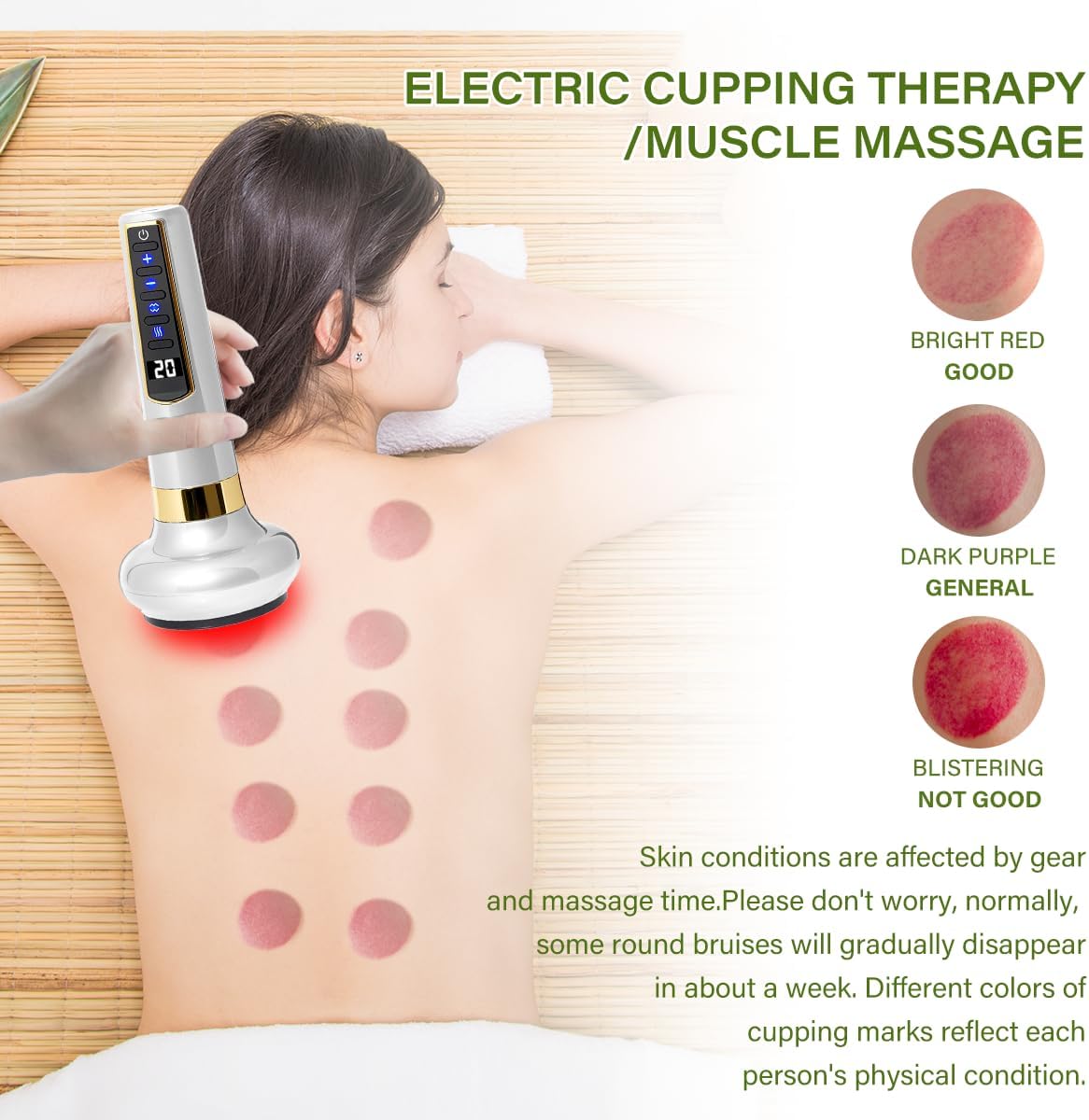 12-Level Intelligent Negative Pressure Cupping Massager – Portable Handheld Fat Reliever