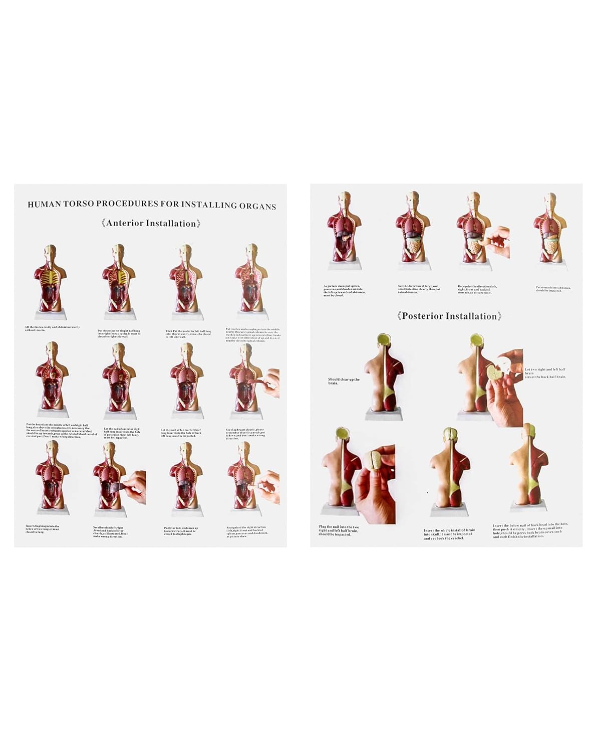 QWORK 15‑Piece Human Anatomy Model with Skull, Brain, Organs – 28 cm