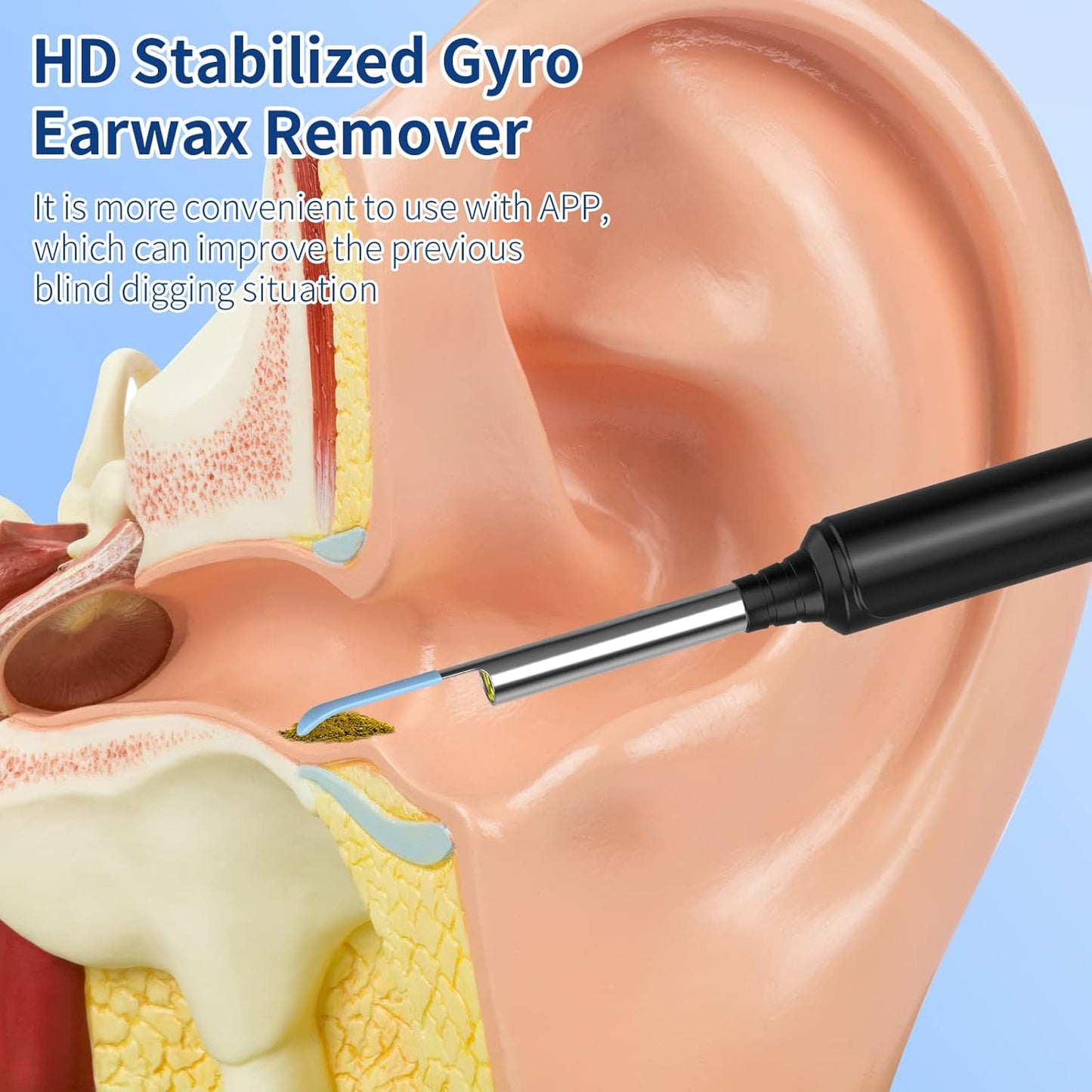 VITCOCO Wireless Ear Wax Removal Otoscope with 1296P HD Camera
