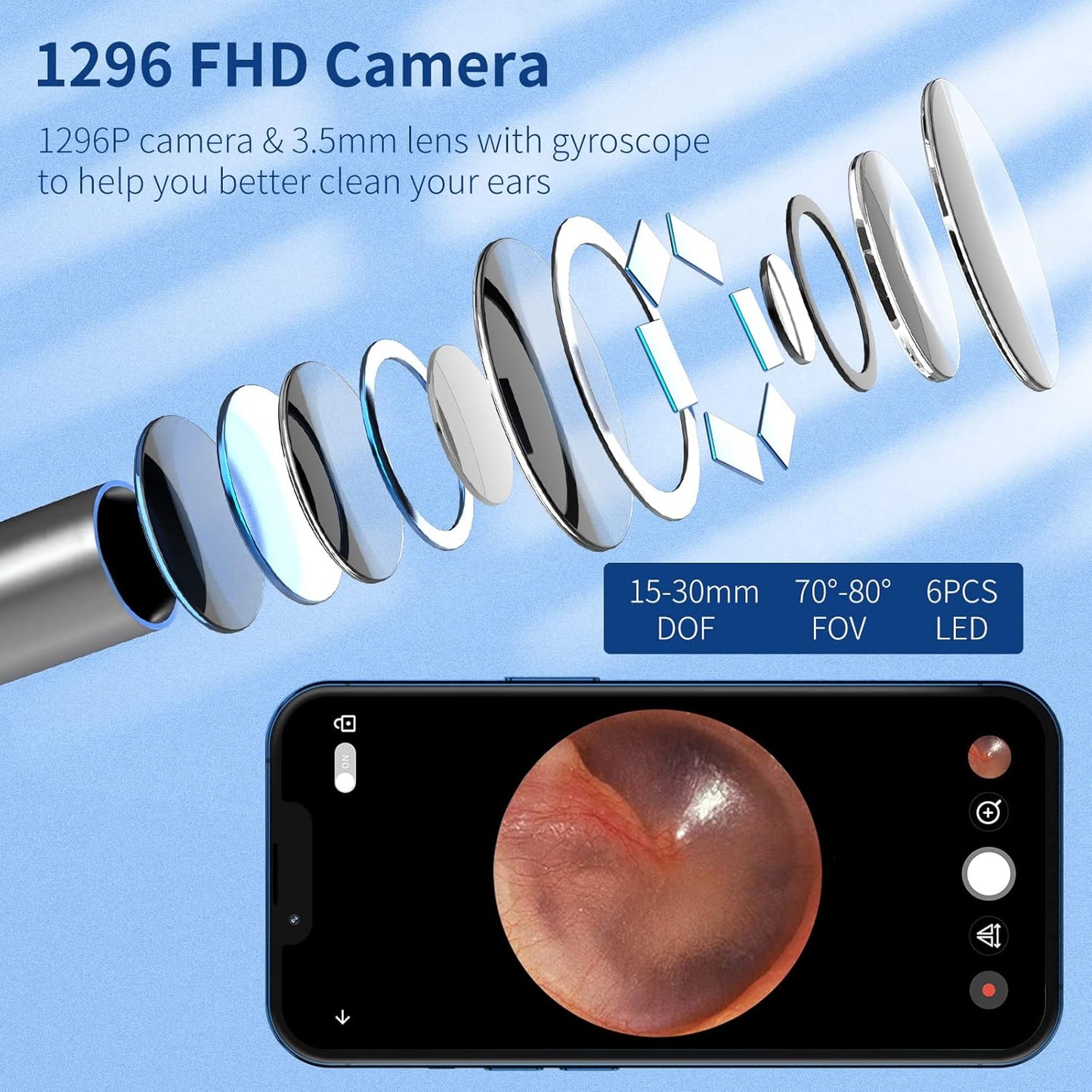 VITCOCO Wireless Ear Wax Removal Otoscope with 1296P HD Camera