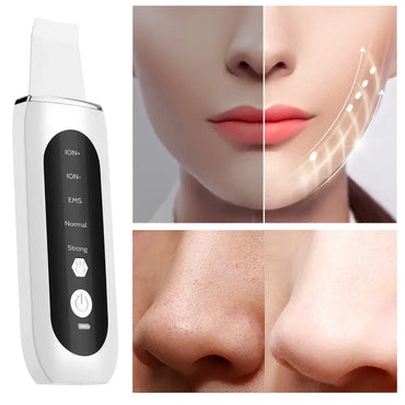 Ultrasonic Skin Scrubber Blackhead Remover - Portable Facial Cleaner - Gomix Brands Outlet
