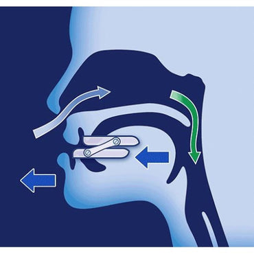 ONIRIS Mandibular Advancement Device Clinically Proven Anti-Snoring Oral Appliance