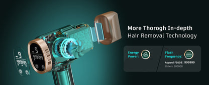 Hand-held IPL Device FZ-608 Laser Hair Removal Machine