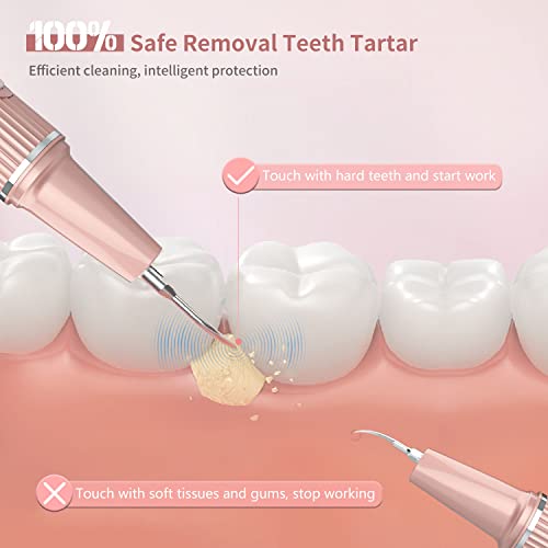 Wi-Fi Visual Ultrasonic Teeth Cleaner Plaque Remover Kit Pink