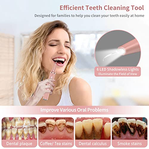 Wi-Fi Visual Ultrasonic Teeth Cleaner Plaque Remover Kit Pink