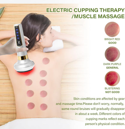 12-Level Intelligent Negative Pressure Cupping Massager – Portable Handheld Fat Reliever