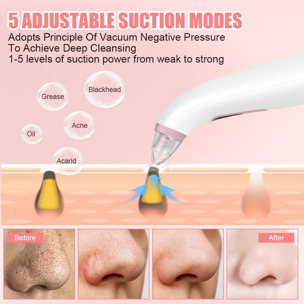 AOGOE Blackhead Remover Pore Vacuum 5 Modes 3 Suction Tips USB Rechargeable White