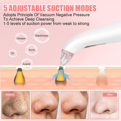 AOGOE Blackhead Remover Pore Vacuum 5 Modes 3 Suction Tips USB Rechargeable White