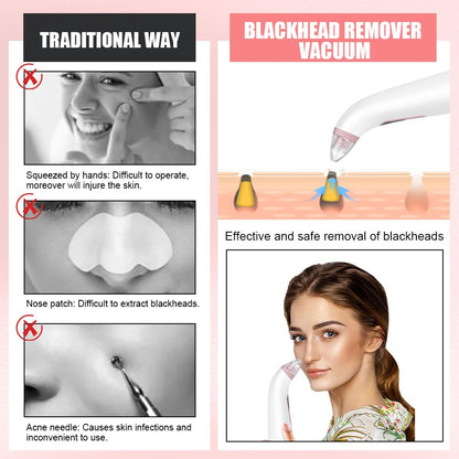 AOGOE Blackhead Remover Pore Vacuum 5 Modes 3 Suction Tips USB Rechargeable White