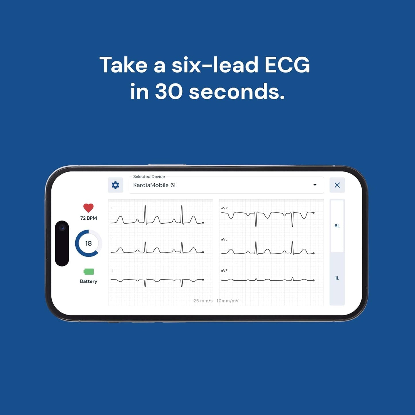 KardiaMobile 6-Lead Personal ECG Heart Rate Monitor – Pocket‑Size Medical‑Grade Tracker