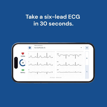 KardiaMobile 6-Lead Personal ECG Heart Rate Monitor – Pocket‑Size Medical‑Grade Tracker