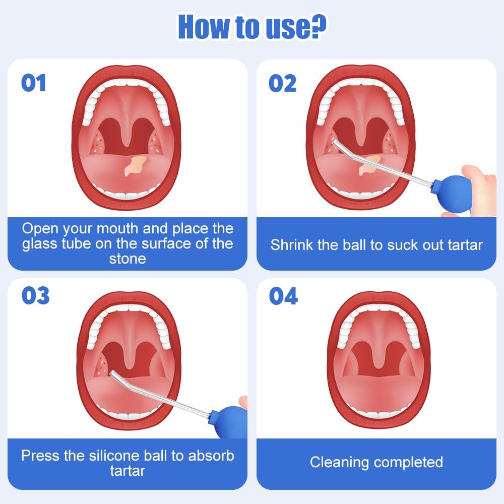 Riisoyu Precise Tonil Stone Removal Kit with Glass Tubes