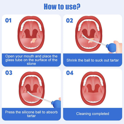 Riisoyu Precise Tonil Stone Removal Kit with Glass Tubes