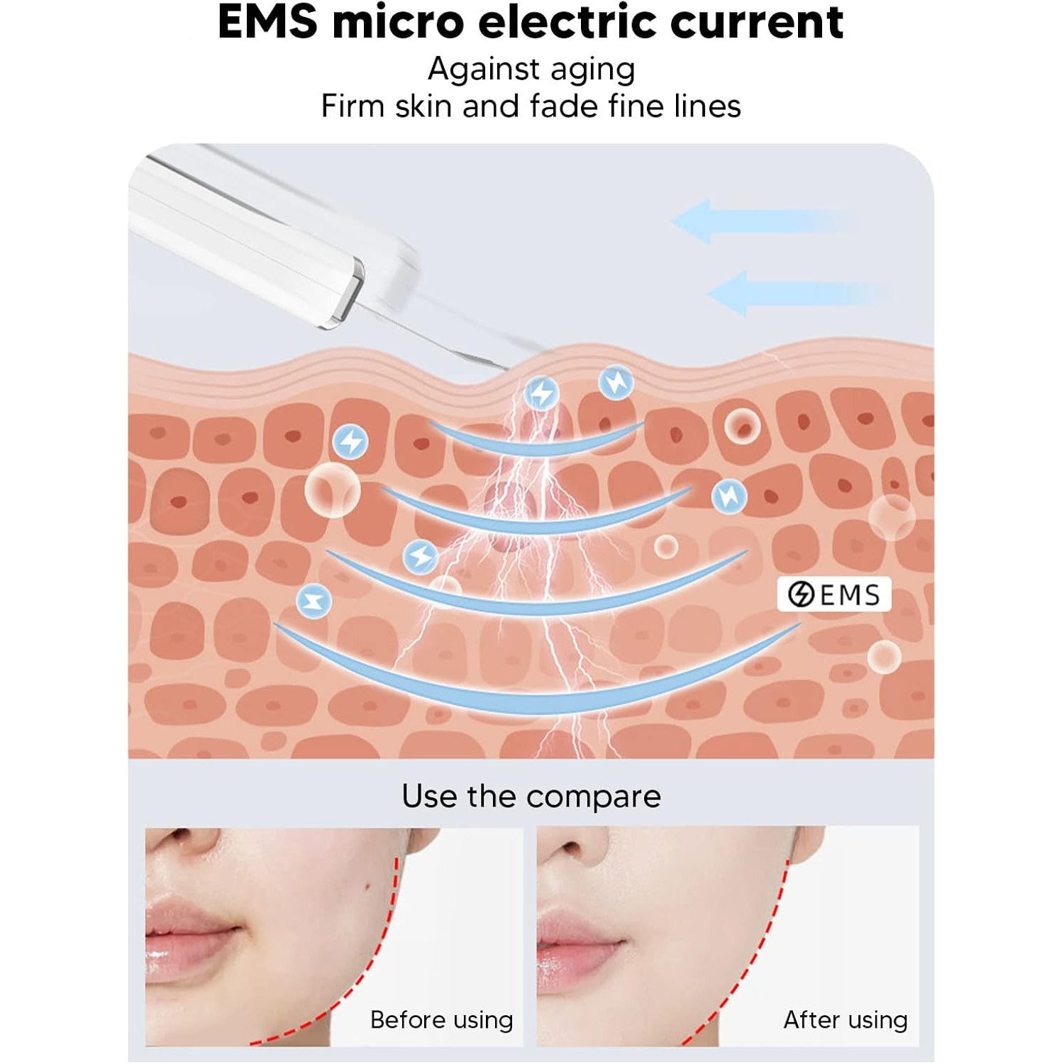 ZJchao Ultrasonic Facial Skin Scrubber Pen for Blackhead Removal
