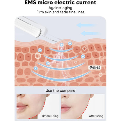 ZJchao Ultrasonic Facial Skin Scrubber Pen for Blackhead Removal