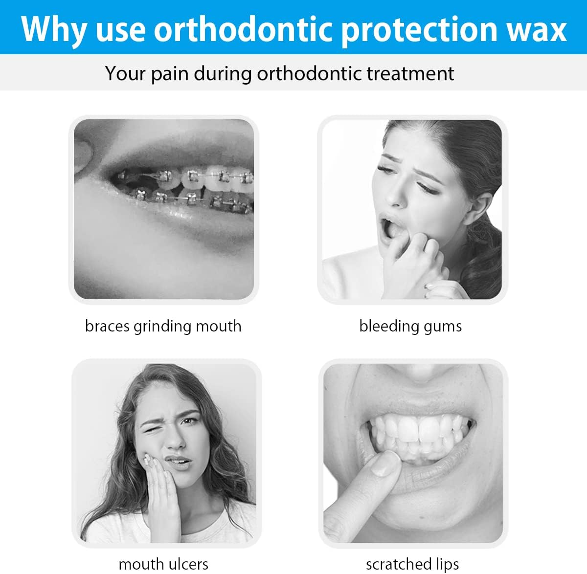 Leikedun Orthodontic Wax for Braces 10 Pack