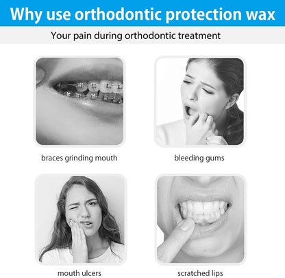 Leikedun Orthodontic Wax for Braces 10 Pack