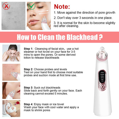 AOGOE Blackhead Remover Pore Vacuum 5 Modes 3 Suction Tips USB Rechargeable White