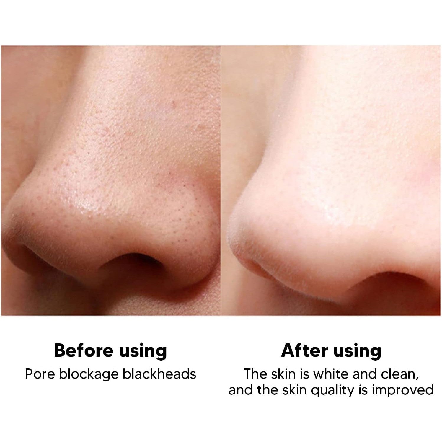 ZJchao Ultrasonic Facial Skin Scrubber Pen for Blackhead Removal