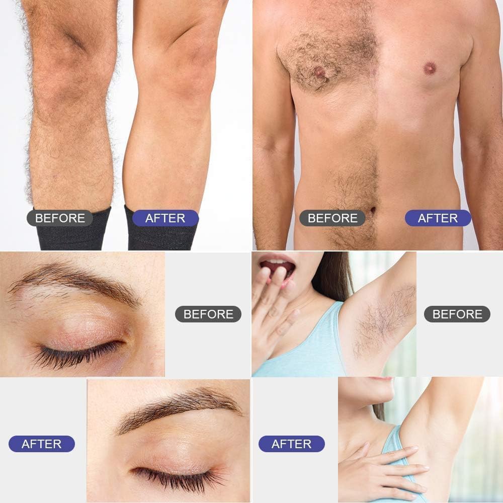 Vinmall Brazilian Wax Heater Waxing Kit Blue DE100E