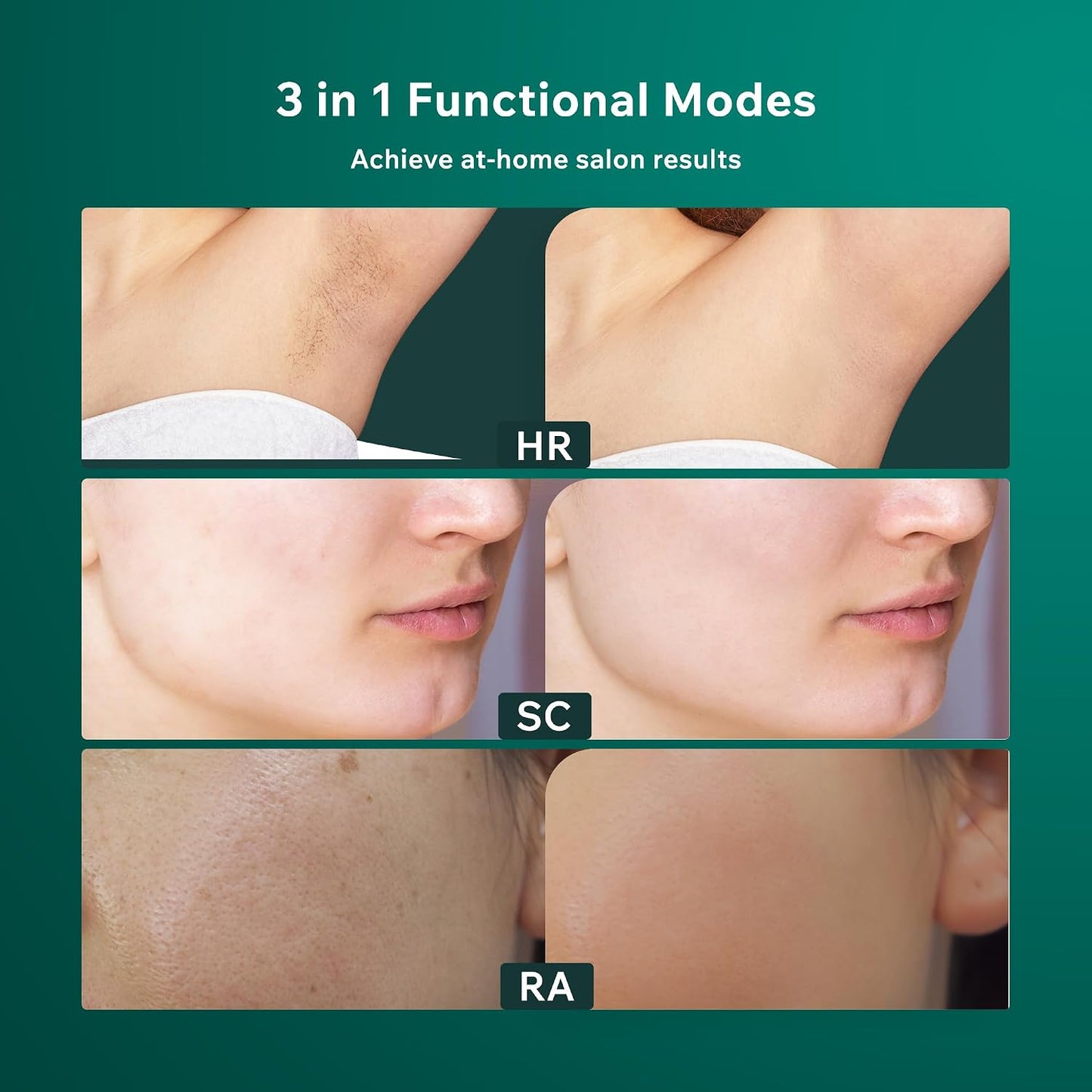 AMINZER IPL Hair Removal Device with LCD Touch Screen
