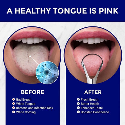 ORAVIX Stainless Steel Tongue Scraper 2-Pack for Fresh Breath