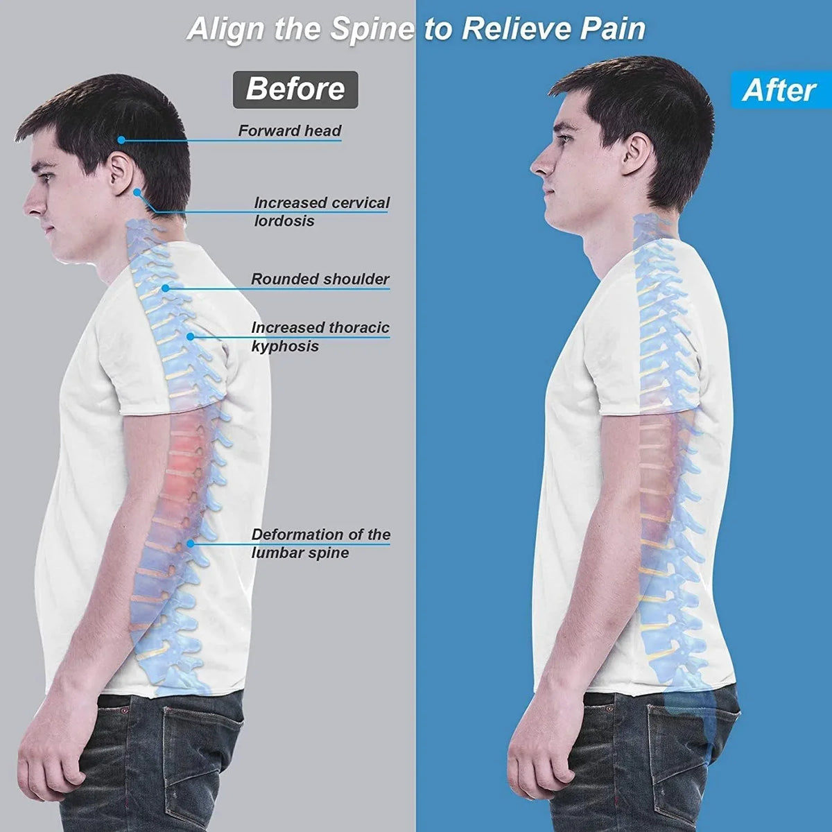 Ultimate Back Posture Corrector for Men and Women, Adjustable Shoulder Support - Gomix Brands Outlet