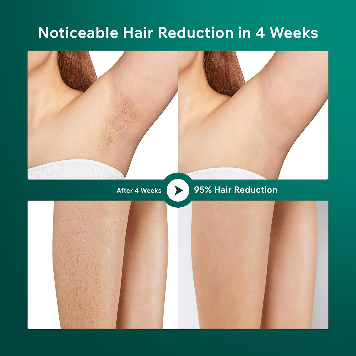 AMINZER IPL Hair Removal Device with LCD Touch Screen
