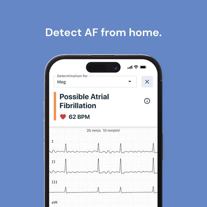 KardiaMobile 6-Lead Personal ECG Heart Rate Monitor – Pocket‑Size Medical‑Grade Tracker