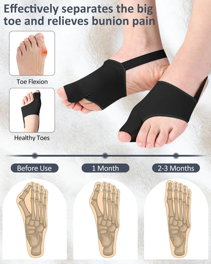 Comfort Fit Bunion Corrector for Pain Relief, Breathable Toe Straightener Spacers