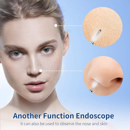 VITCOCO Wireless Ear Wax Removal Otoscope with 1296P HD Camera