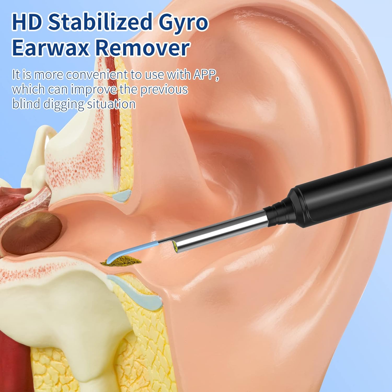 VITCOCO Wireless Ear Wax Removal Otoscope with 1296P HD Camera