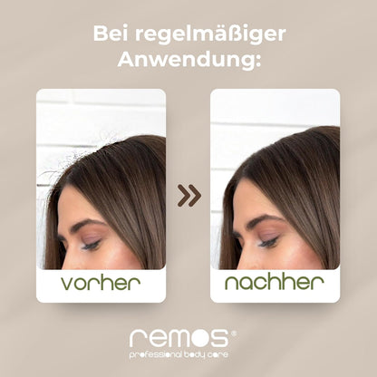 REMOS Walnut Wood Wild Boar Bristle Hairbrush – Ergonomic Detangling