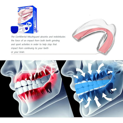ConfiDental Moldable Night Guard – 3‑Model Pack, BPA‑Free, Blue - Gomix Brands Outlet