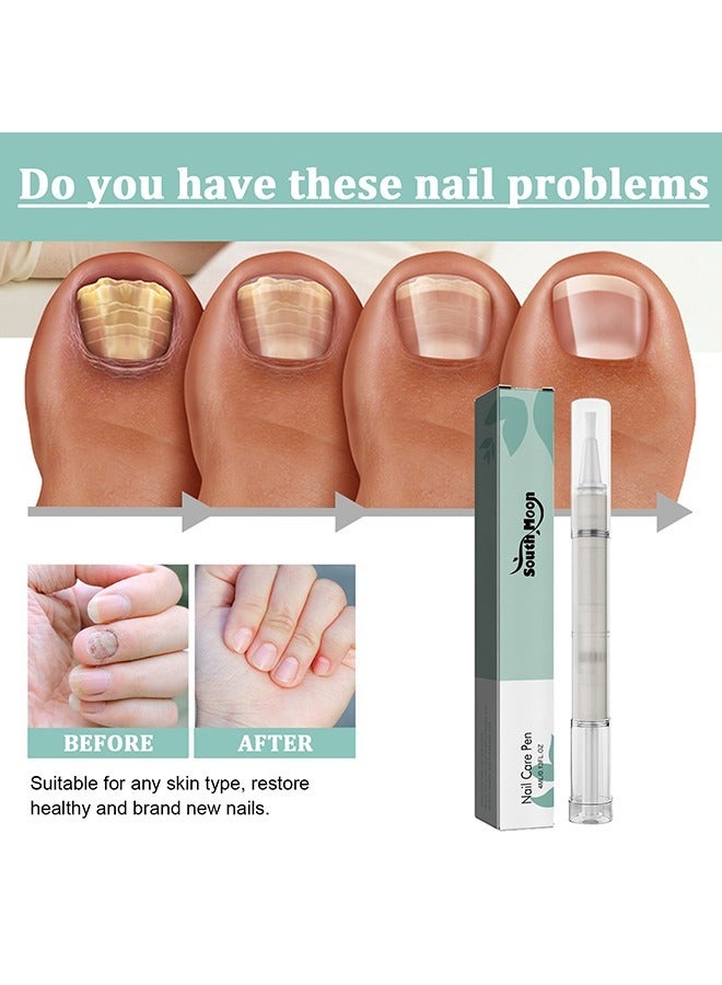 SOUTH MOON Advanced Nail Repair Pen for Onychomycosis, Dead Skin, and Moisturizing