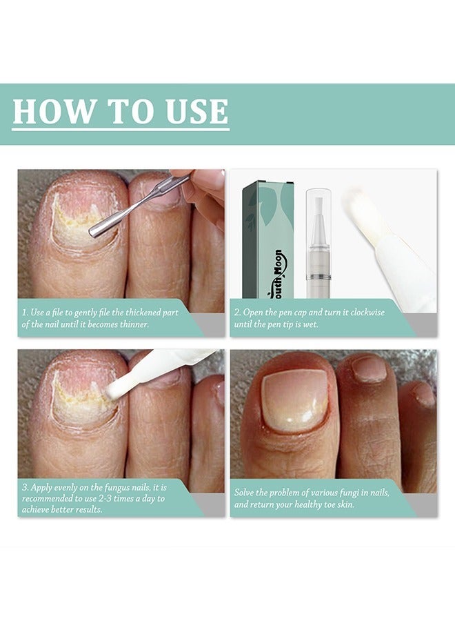 SOUTH MOON Advanced Nail Repair Pen for Onychomycosis, Dead Skin, and Moisturizing