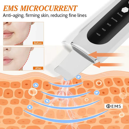 Ultrasonic Skin Scrubber Blackhead Remover - Portable Facial Cleaner - Gomix Brands Outlet