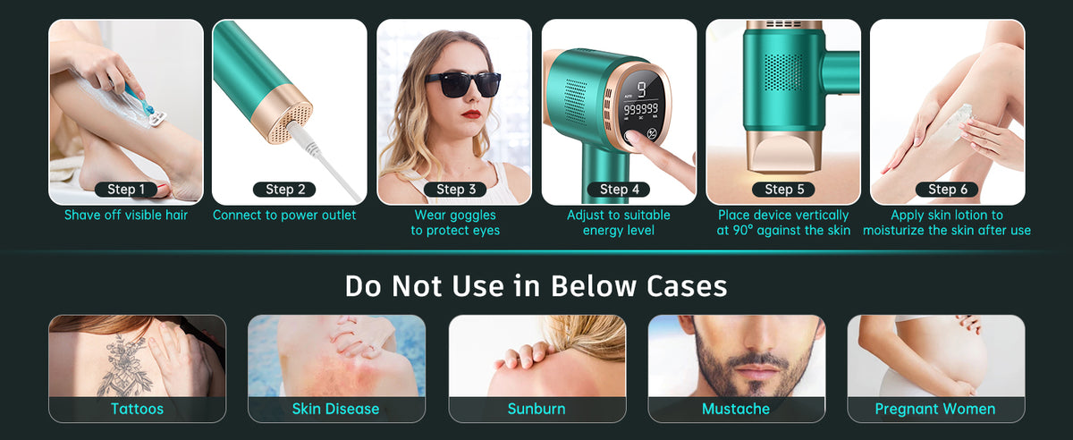 FZ FZ-608 IPL Hair Removal Device 36W