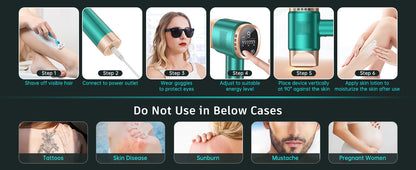 FZ FZ-608 IPL Hair Removal Device 36W