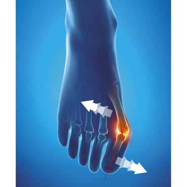 Epitact Flexible Hallux Valgus Correction Bandage for Daily Wear, Small Size