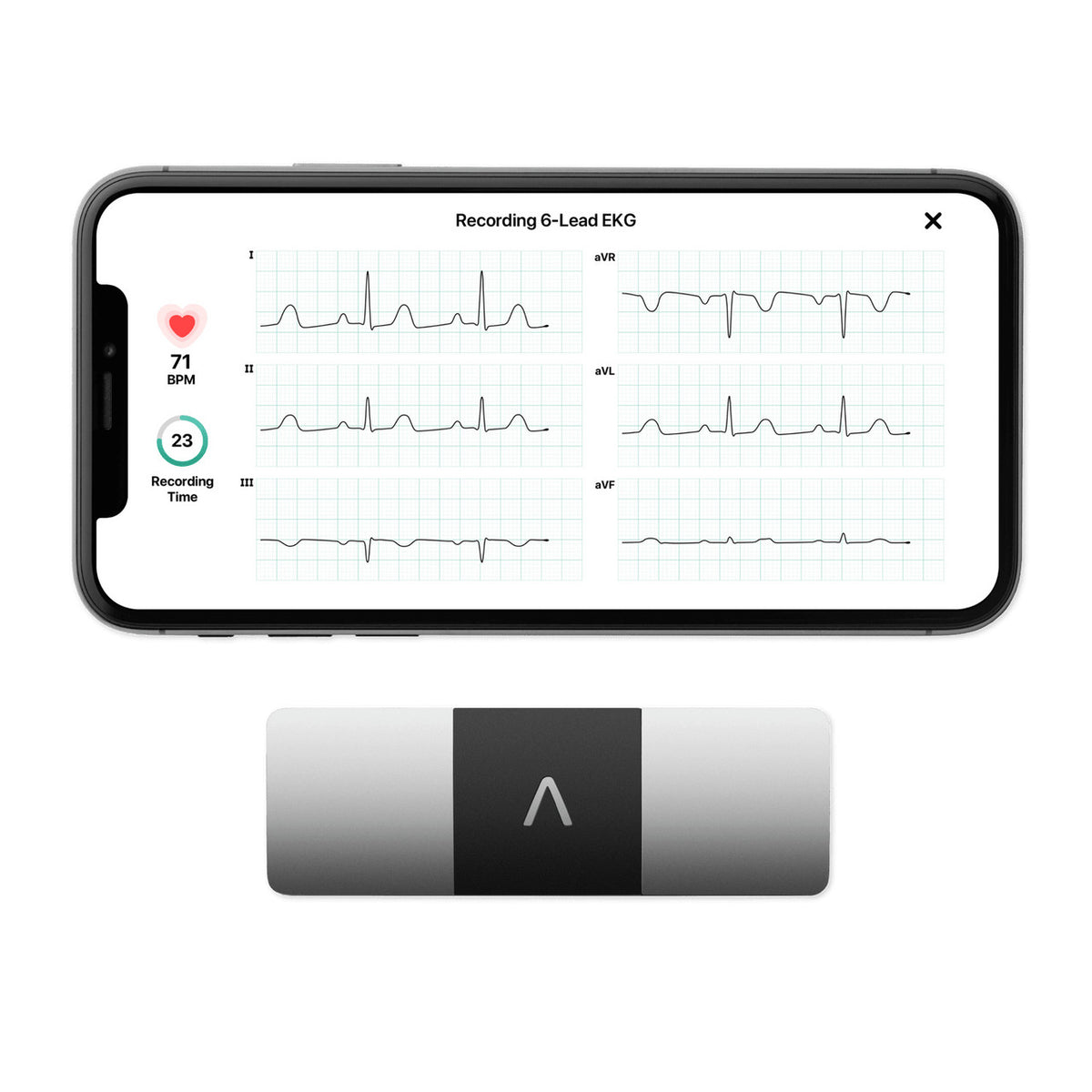 Kardia KardiaMobile 6L 6-Lead Personal EKG Device