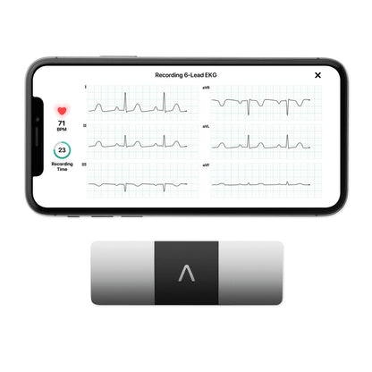 Kardia KardiaMobile 6L 6-Lead Personal EKG Device