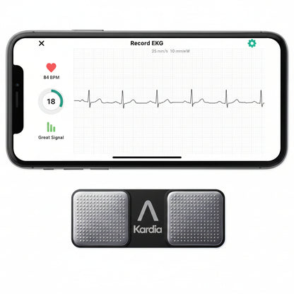 AliveCor KardiaMobile Personal EKG Monitor