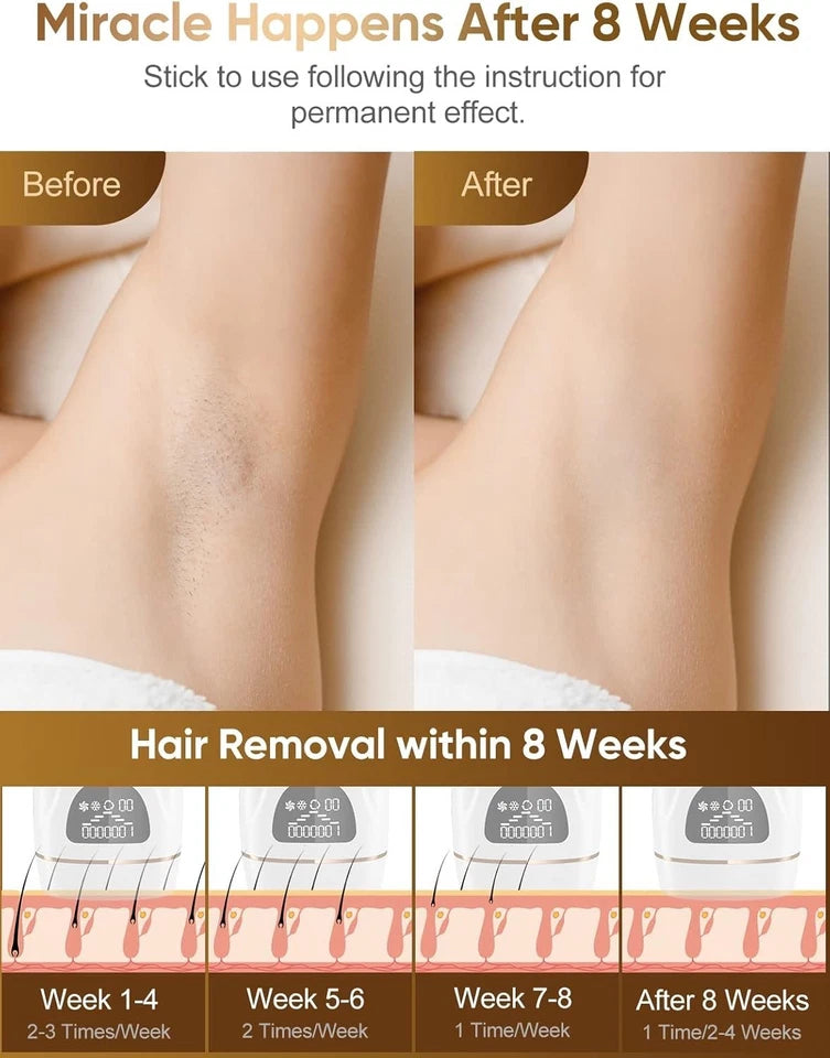 IPL Hair Removal Device with Freezing Function 9 Energy Levels