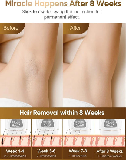IPL Hair Removal Device with Freezing Function 9 Energy Levels